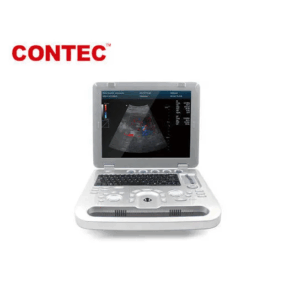 CONTEC CMS1700A